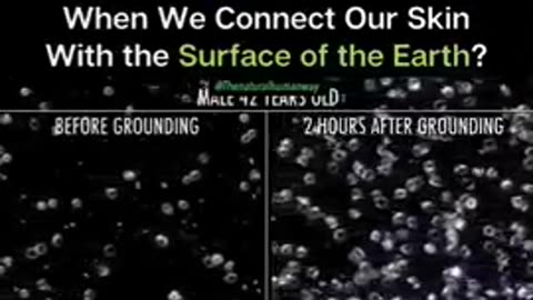 Benefits Of Grounding