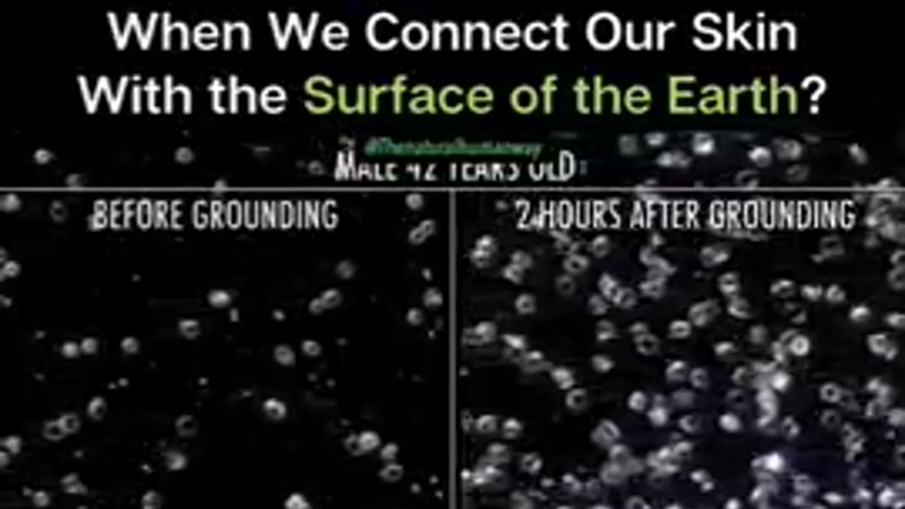 Benefits Of Grounding