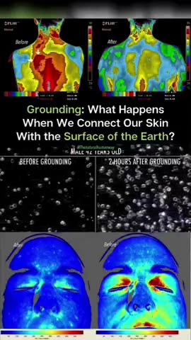Benefits Of Grounding