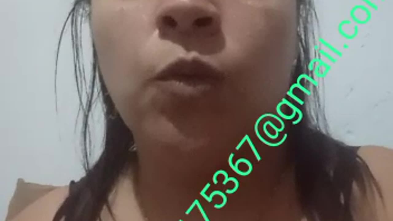 Joyce Lopes vítima da 💉