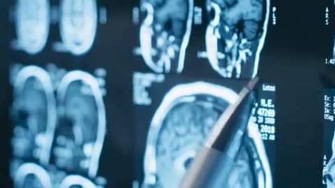 Pay $500 for an MRI, not $5000!
