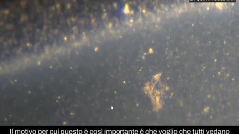 Dott.ssa Ana Mihalcea presenta i risultati del suo lavoro con sangue di non vaccinati