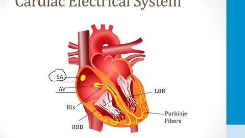 Cardiology - 4. Arrhythmias - 5.WPW