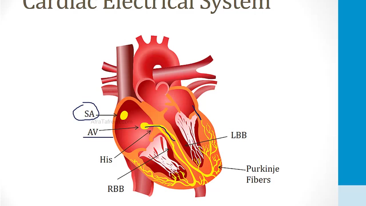 Cardiology - 4. Arrhythmias - 5.WPW