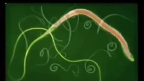 Parasites and detox