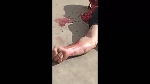 SUICIDE SAVAGERY (COMPILATION)