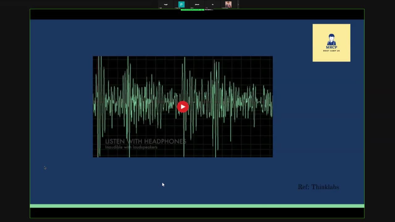 ST3.Examine the CVS of a 70 year old patient