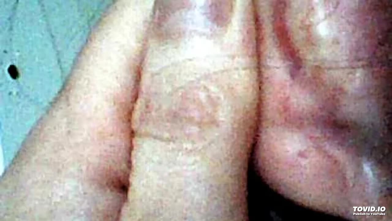 Targeted individual; non consensual surgery, unexplained scars behind BOTH ears implants? Eliza Parr