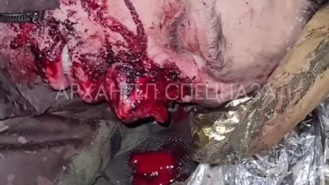 Not all Ukrainian warriors set out their arms on time