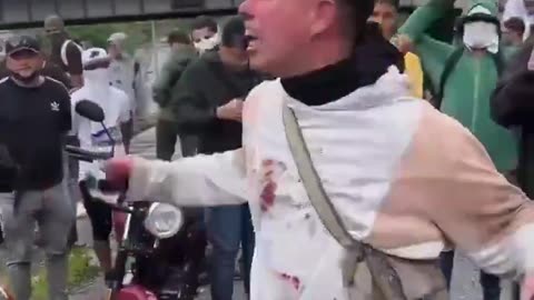 "Bloodied Hero Urges Venezuelans to Fight for Freedom After Dramatic Rescue in Caracas"