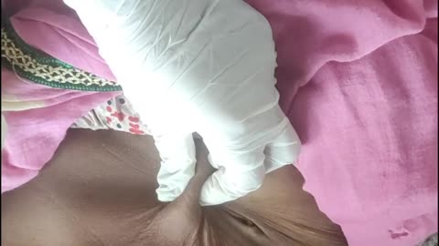 HOW TO GIVE INSULINE INJECTION