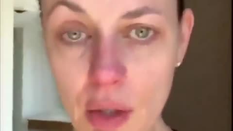 "I got bell's palsy from the Covid vaccine...