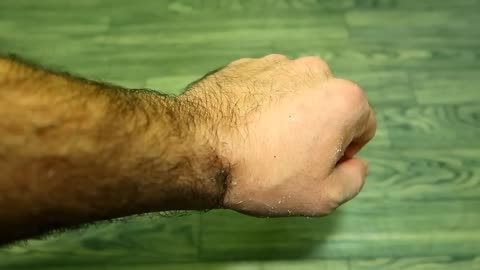 Permanent hair removal video