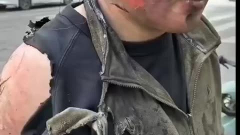 Spontaneous combustion of an electric car almost killed him