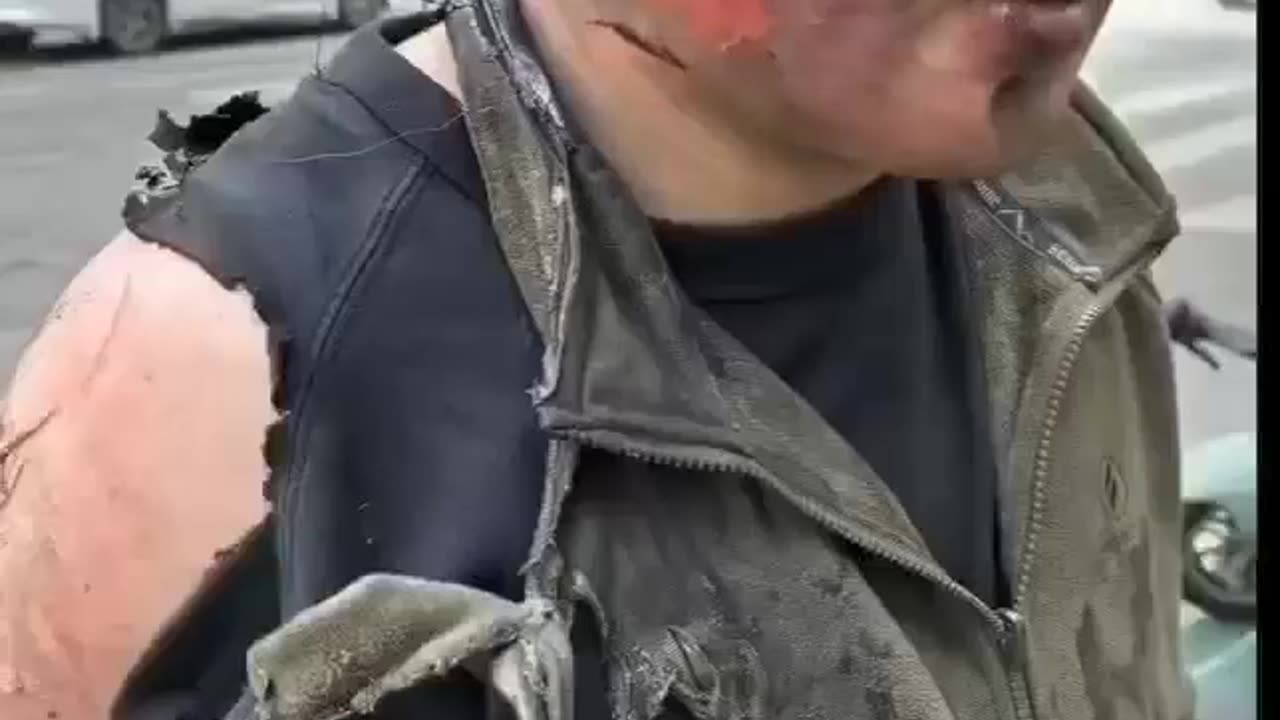 Spontaneous combustion of an electric car almost killed him