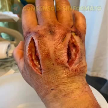 A questo gli è andata veramente, ma veramente molto male.