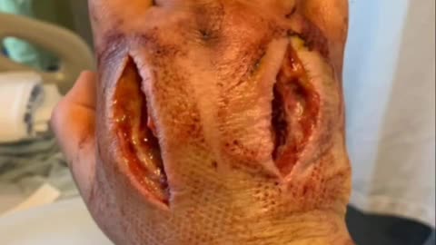 A questo gli è andata veramente, ma veramente molto male.