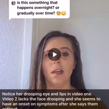 A VERY common side effect from the JAB