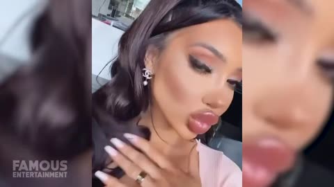 Chloe Khan _ Before & After _ How Plastic Surgery Ruined Her Health_