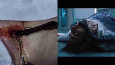 Black Goo(Venom) in Blood...cause of Sudden Death Syndrome