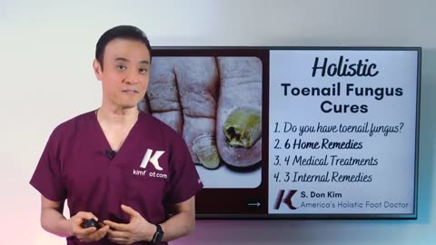 Get rid of Toe Fungus at Home