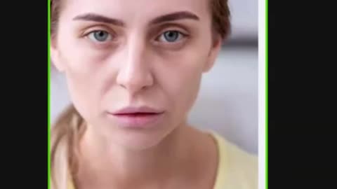 ST5.32 year old year old lady with fatigue, BP 92-61