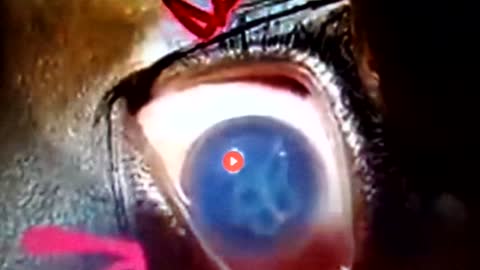 Parasites from the Time Release Death Injections: