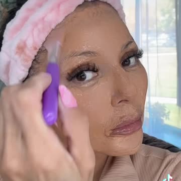 Microneedling and Radio Frequency Treatment