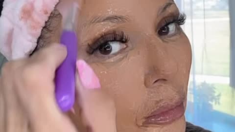 Microneedling and Radio Frequency Treatment