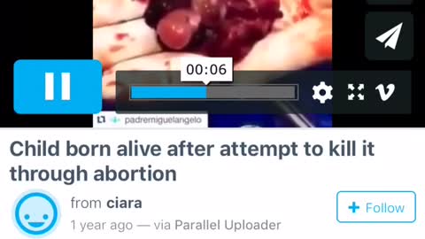 Tiny baby still alive after abortion
