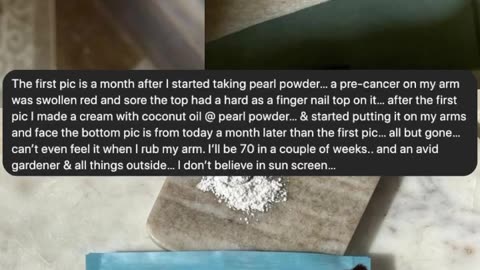 Pearl and Skin Healing