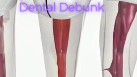 Cracked tooth