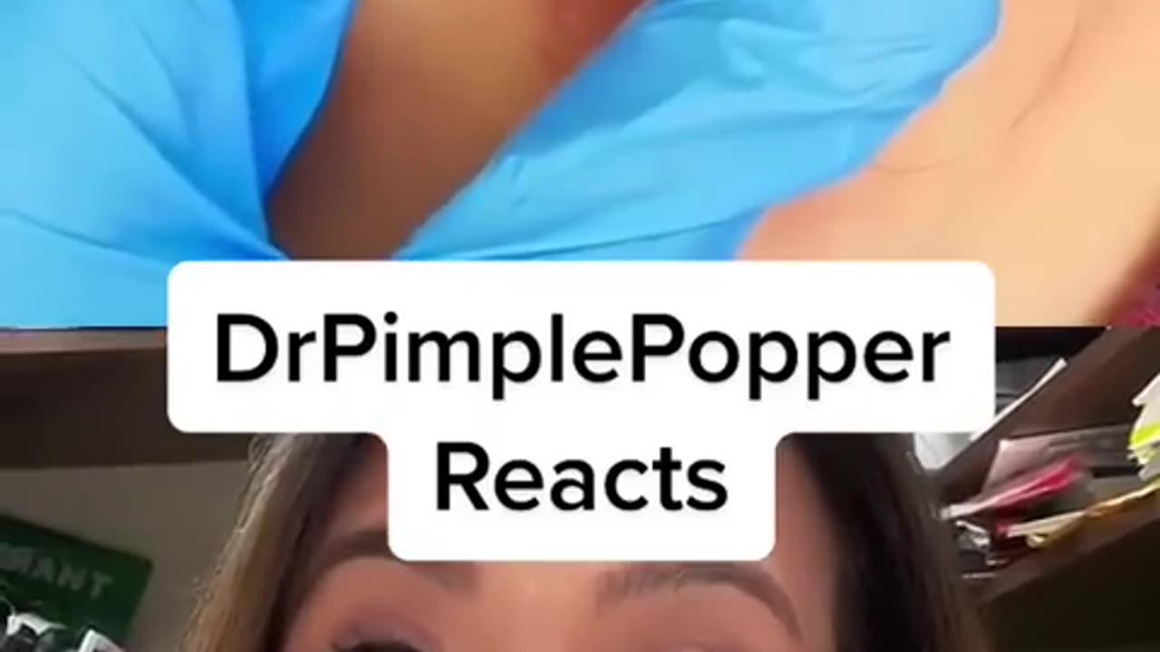 TOO SATISFYING TO BE REAL? Dr Pimple Popper Reacts