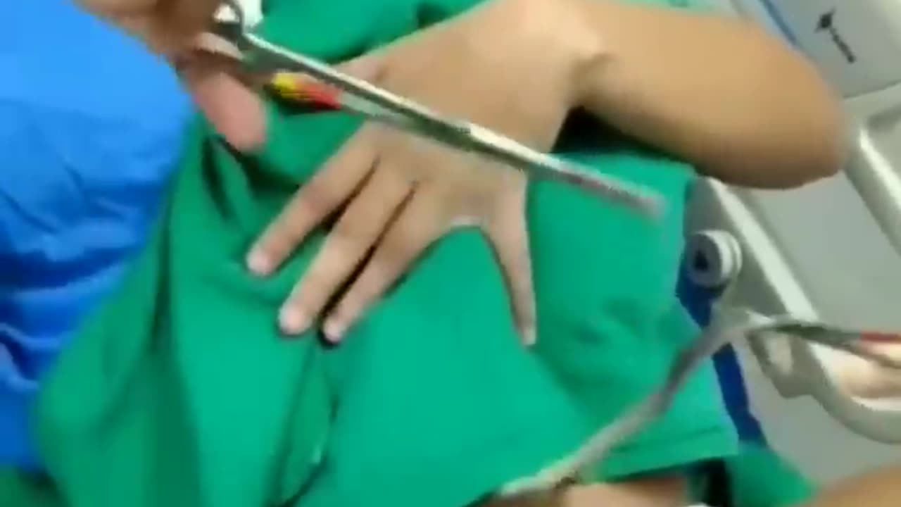 live birth, mother cuts the umbilical cord herself