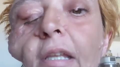 Quarta dose