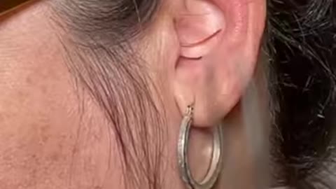 Not sure what they pulled from her ear 😳
