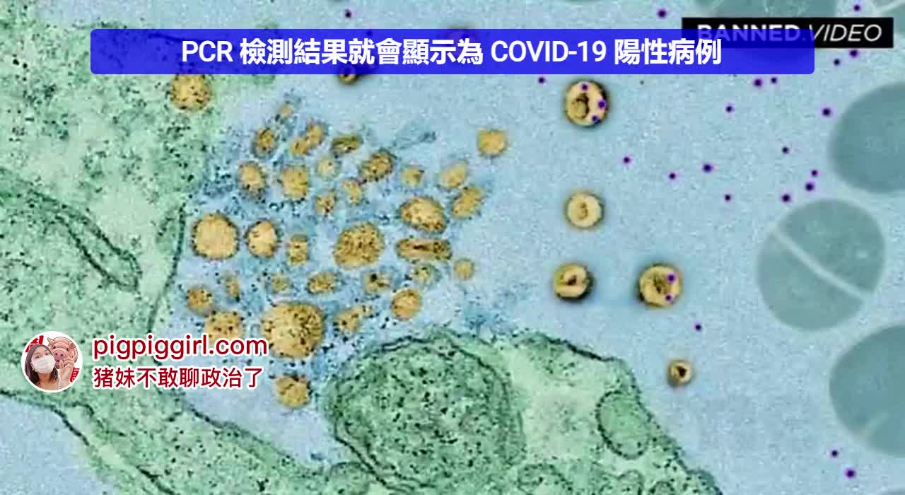 【Warning】5G可以导致病毒测试阳性!波技术诱导外泌体,没病变有病!