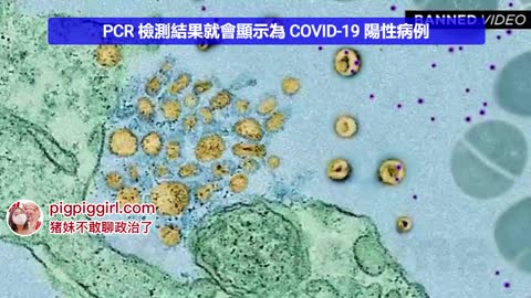 【Warning】5G可以导致病毒测试阳性！波技术诱导外泌体，没病变有病！