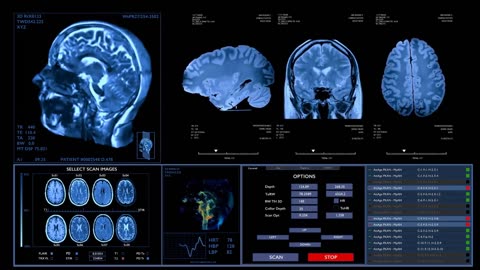 Dartmouth Researchers Have Mapped How the Brain Regulates Emotions