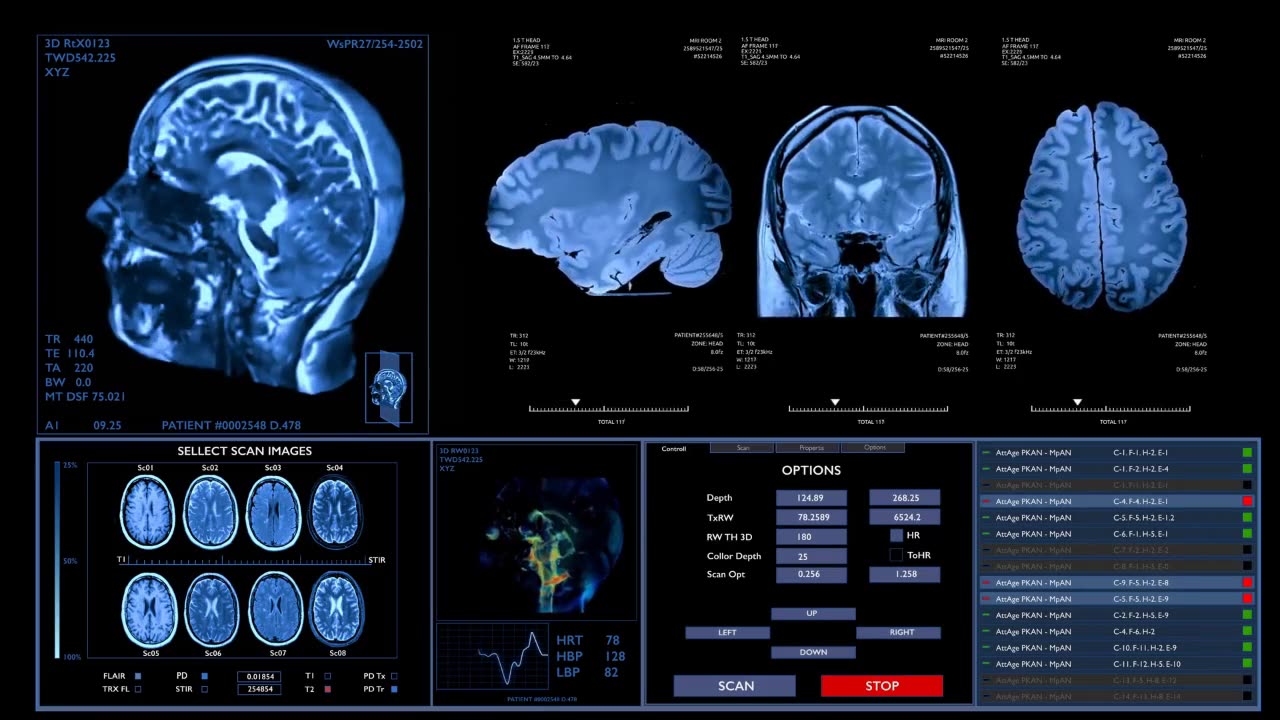 Dartmouth Researchers Have Mapped How the Brain Regulates Emotions