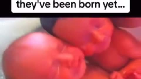 Twins who don't know they've been born yet