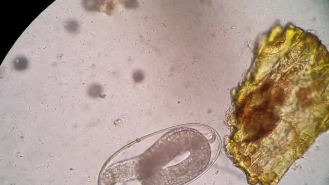 Nematodirus parasite ova