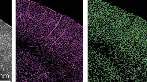 Age-Related Cognitive Decline Linked to Blood Vessel Health