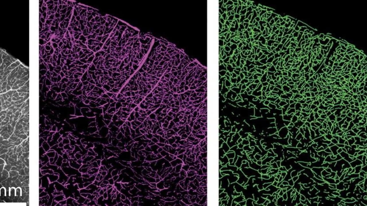 Age-Related Cognitive Decline Linked to Blood Vessel Health