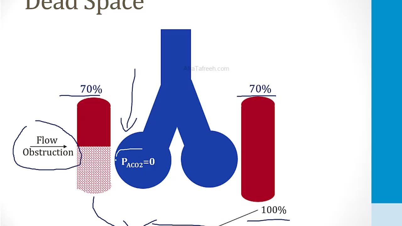 Pulmonary - 1. Embryology, Anatomy and Physiology - 6.Ventilation and Perfusion