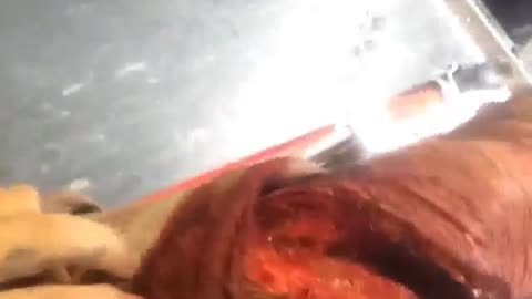 Man Attacked By A Tiger Shark Films Aftermath
