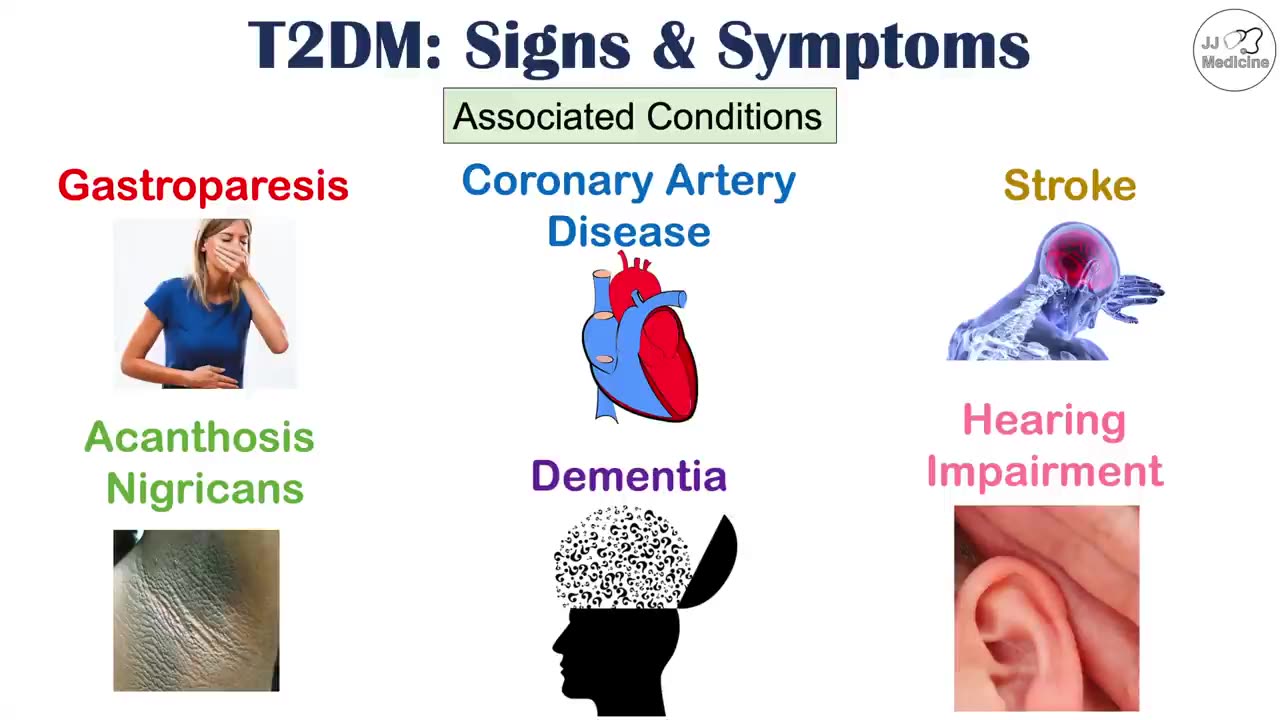 Signs & Symptoms for Type 2 Diabetes