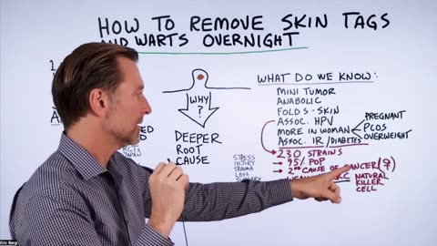 How to Remove Skin Tags and Warts Overnight - Dr. Berg Explains