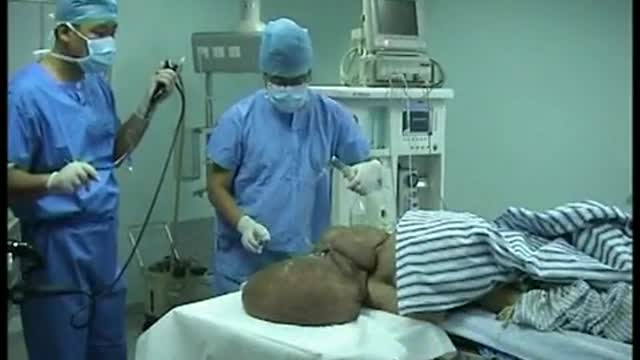 Elephant Man