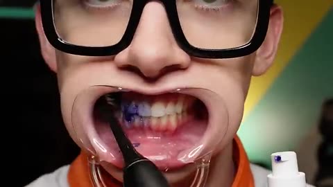 Teeth whitening toothpaste